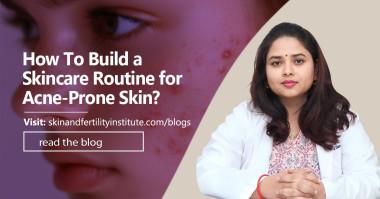 How To Build a Skincare Routine for Acne-Prone Skin?