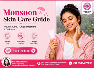Monsoon Skin Care Guide: Keep Your Skin Healthy During the Rainy Season